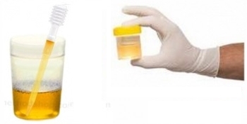 Echantillon d'urine, urée, carbamide, E927b, additif